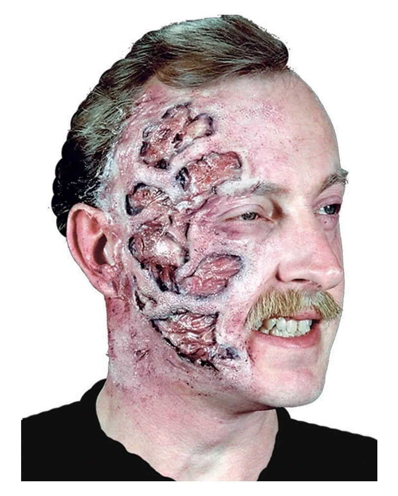 Brandopfer Latexwunde 3 Brandopfer Latexwunde